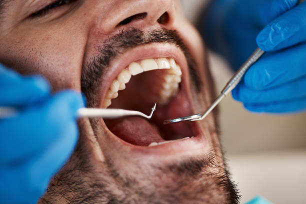 Best Mobile Emergency Dentist in Corinth, TX
