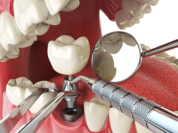 Best Broken or Cracked Tooth Emergency Dentist in Corinth, TX